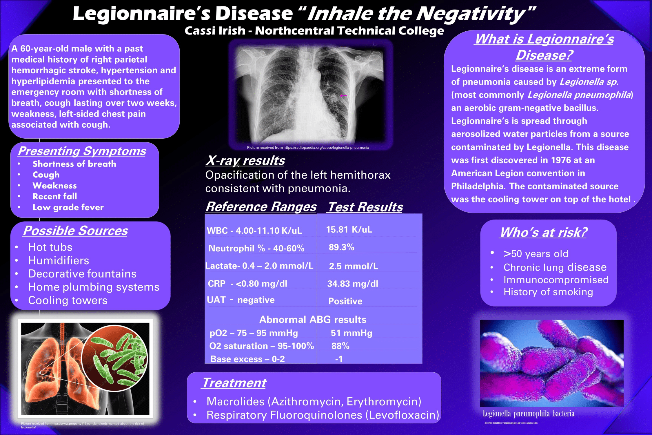 Legionnaire's Disease - Inhale the Negativity poster by Cassi Irish